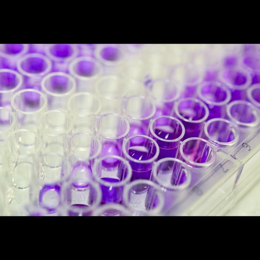 [0772-E5357Hu] Human Gsize:protein Coupled Receptor 55, GPR55 ELISA Kit size: 96 Tests